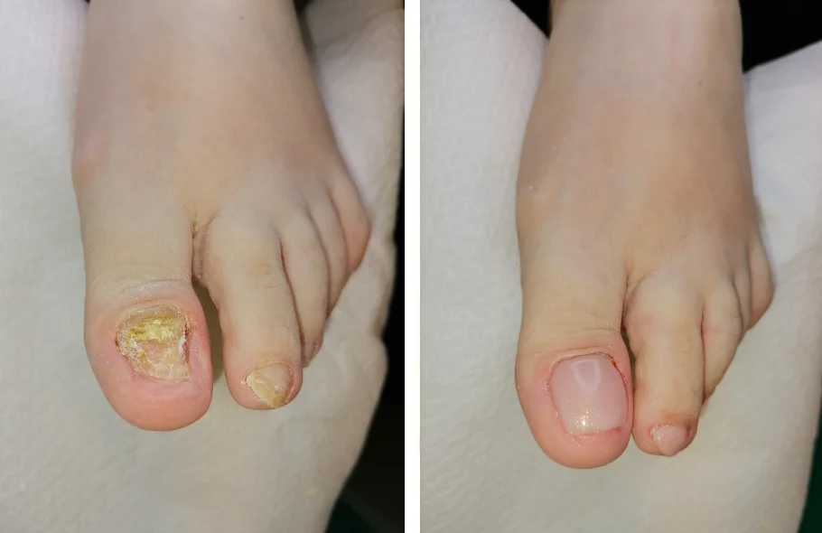 Problemi stopala i rješavanje problema u salonu Kristina